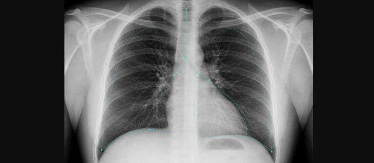 Only 1% Can Identify All These X-Ray Images &mdash; Are You One of Them?